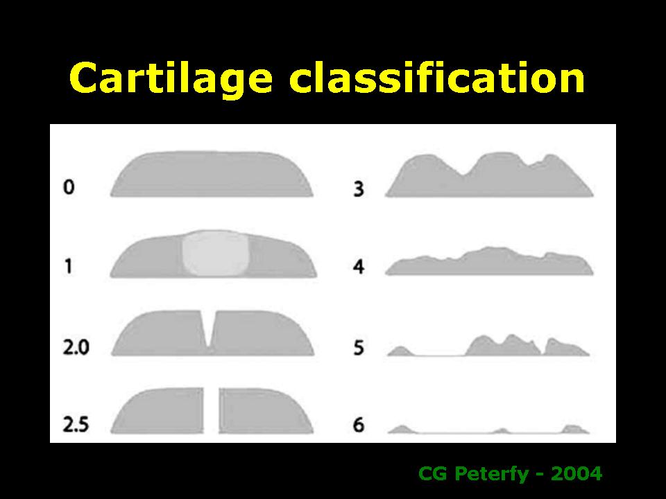 cartilage-classifi